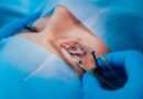 lasik eye surgery